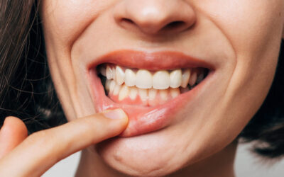 When to See a Periodontist in Santa Monica: Warning Signs You Shouldn’t Ignore